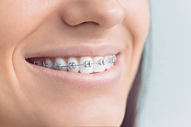 Best Veneers and Lumineers  in Beacon Hill, WA