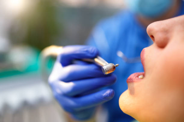 Best Teeth Whitening  in Beacon Hill, WA